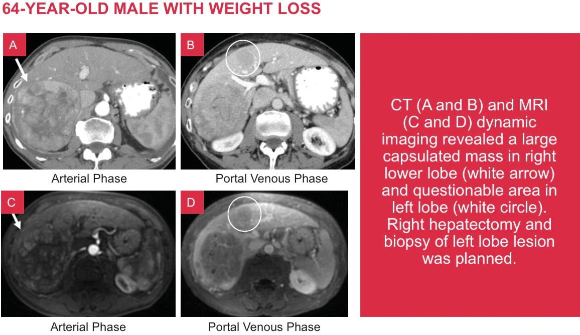 Fnh Radiology Eovist at Elizbeth Roberts blog